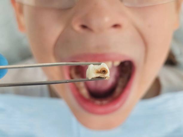 Best Same-Day Emergency Dentist in Round Lake Park, IL